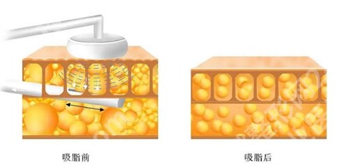 台州医院整形科哪个医生好点？看医院特色项目介绍