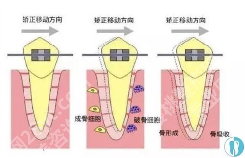 江苏省中医院牙齿矫正怎么样？特色项目在线一览