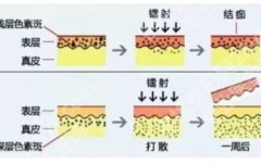 南京(江苏)省人民医院点阵激光价格？医院好评如潮