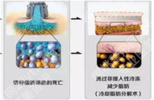 金华中心医院抽脂怎么样？一键查看特色项目，医院实力曝光