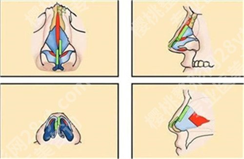 宁波第六医院做鼻子好吗？科普知识小分享