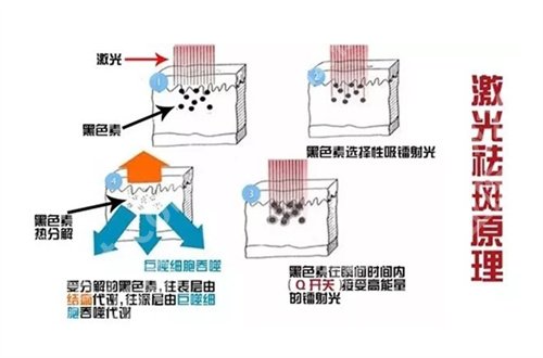 苏大附一院美容科价格怎么样？先关收费与简介来了