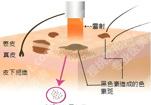 扬州苏北医院祛斑挂什么科？含科室资料，分享主打项目介绍