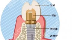 无锡人民医院可以种植牙齿吗？主打项目介绍，价格公布