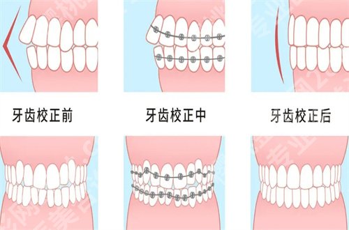 北京东方医院口腔科穆宏咋样？核心项目已经做出回答