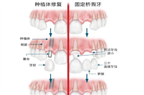 北京东方医院口腔科穆宏咋样？核心项目已经做出回答