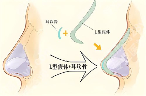 阜阳市人民医院光子嫩肤怎么样？优势项目汇聚，一起看介绍