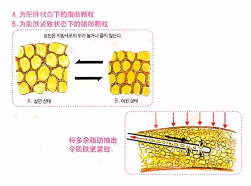 北京空军总医院吸脂专家有谁？一览医院特色项目介绍