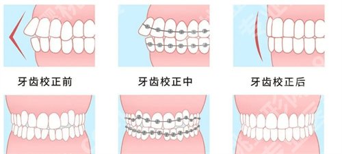 北京301解放军总医院口腔专家有谁？一览详情介绍