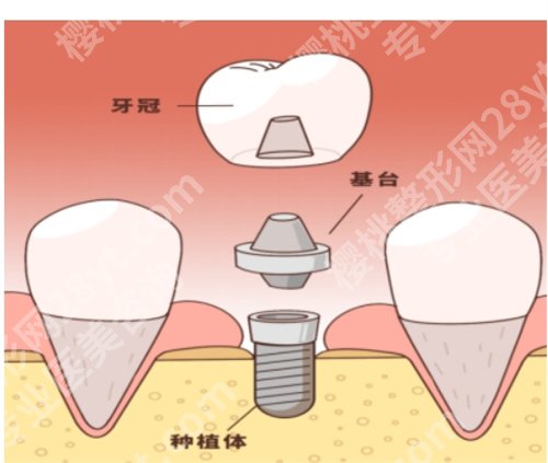 清华大学玉泉医院口腔科高洁怎么样？看核心项目介绍