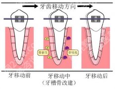 深圳北大医院牙齿矫正收费贵吗？项目介绍，一文了解医院详情