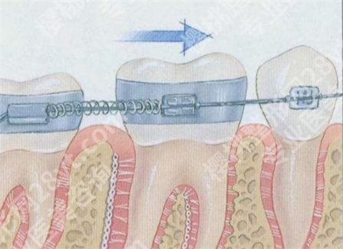 深圳美奥口腔做矫正怎么样？医院详情介绍，案例分享