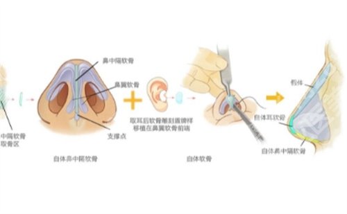 广东美恩整形医院是正规医院吗？一键了解医院实力