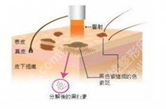 深圳阳光整形医院是正规医院吗？医院详情介绍，速速了解