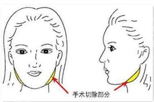 吴中兴怎么样？坐诊在哪？看资料的重点分析