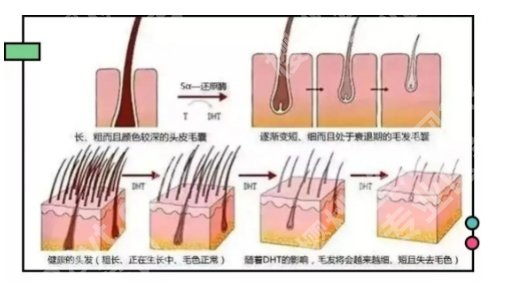 碧莲盛发际线种植怎么样？好评不断，医院简介