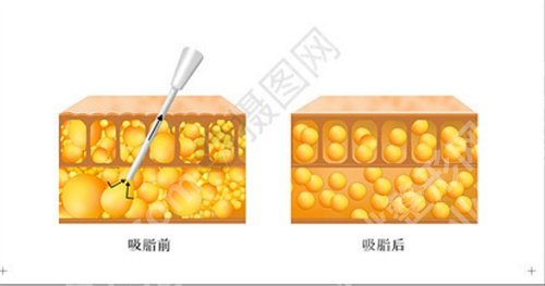 华美医院做脂肪填充哪个医生比较好？看医生名单一览