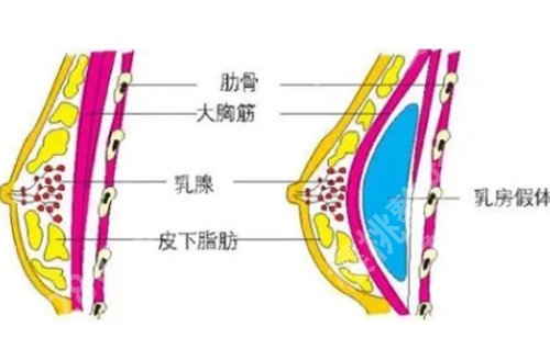 上海九院做胸好的专家怎么样？主打项目公布