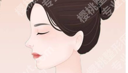 北京艺星医疗美容医院假体隆鼻怎么样？费用如何？真实案例分享！