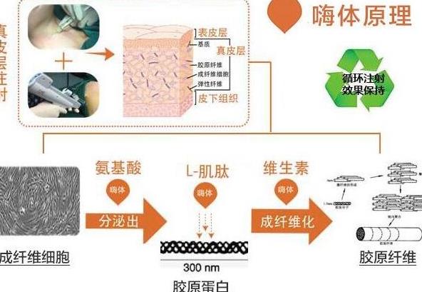 嗨体注射脖子除皱的果好不好？果可以维持多久呢？