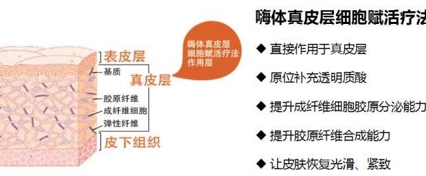 嗨体注射脖子除皱的果好不好？果可以维持多久呢？