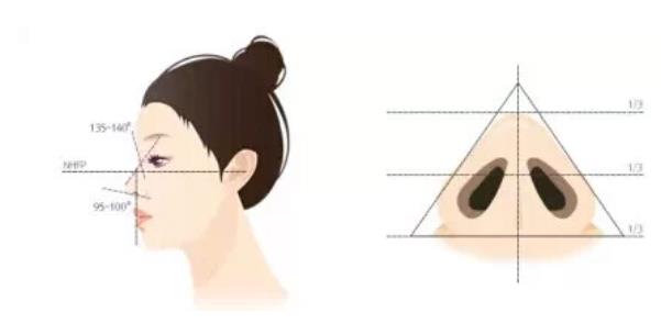 鼻翼缩小有几种方法？鼻翼缩小手术风险大吗？注意事项分享