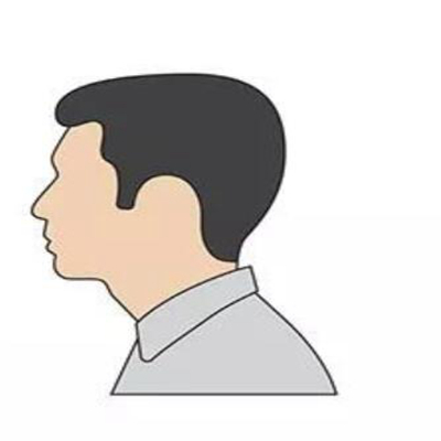植发的注意事项是什么？详细情况看这里！