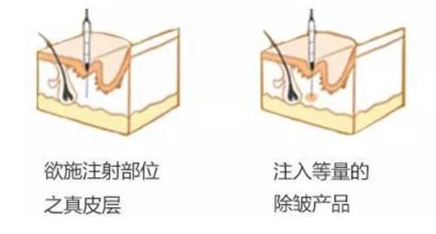 成都铜雀台吴沙冰医生擅长项目有哪些？皮肤除皱过程是怎么样的？