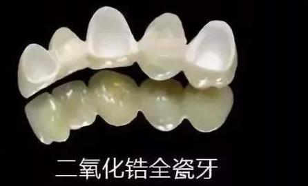 成都烤瓷牙价格是多少？费用贵不贵呢？