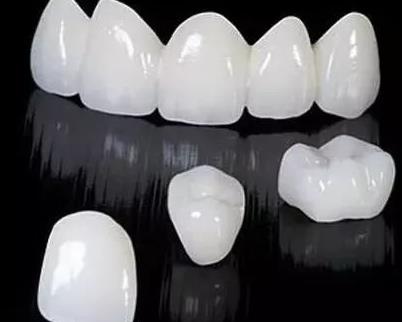 烤瓷牙种类和价格有哪些？看哪一种为实用呢？
