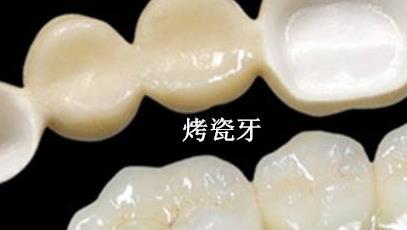 老年人换牙齿需要多少钱？具体价格受哪些影响？