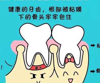老年人换牙齿需要多少钱？具体价格受哪些影响？