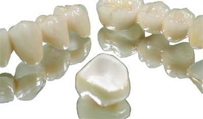 上海钴铬烤瓷牙价格多少钱？认清牙齿情况