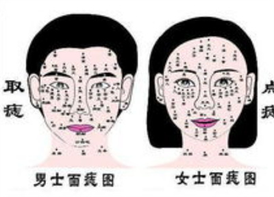 激光点痣多少钱？价格受哪些因素影响？