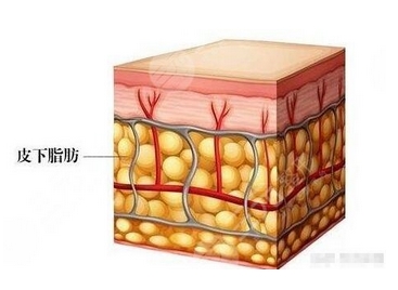 镭射溶脂价格是多少呢？注意事项有哪些呢？反手就是一个收藏！