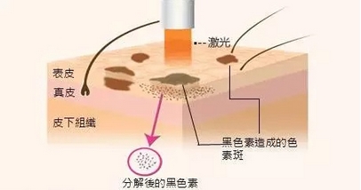 北京协和医院激光收费是多少？传统优势项目有多热门！附医生详细介绍~