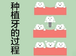 北京大学第一医院种牙多少钱？种植牙的过程|抢先看种牙案例介绍！附价目表~