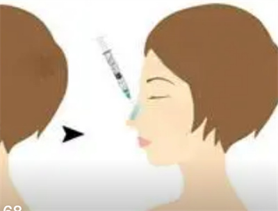 注射胶原蛋白隆鼻多少钱？注射胶原蛋白隆鼻术后护理事项？