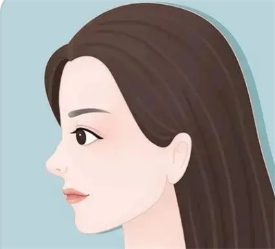 注射隆鼻手术多少钱？不同鼻子基础条件影响价格吗？