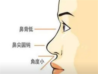 北京整鼻子多少钱?整形价格受哪些因素影响？