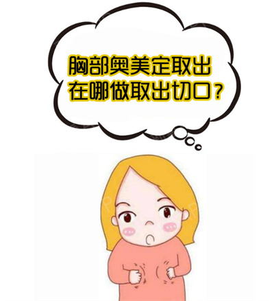 奥美定取出价格是多少？受哪些因素影响？注意事项？