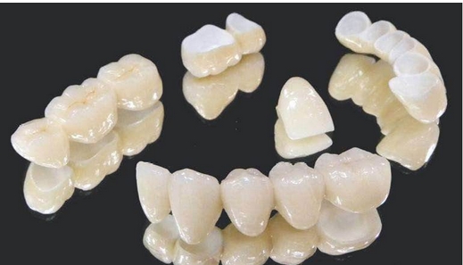 全瓷牙的报价是多少？在材料上有什么优势？修复时怎样选择医院？