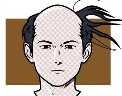 种头发价格是怎样算的?种头发价格受哪些因素影响？