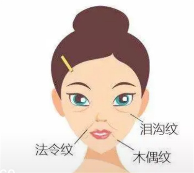 怎样去掉脸上的皱纹？去掉脸上的皱纹小妙招？