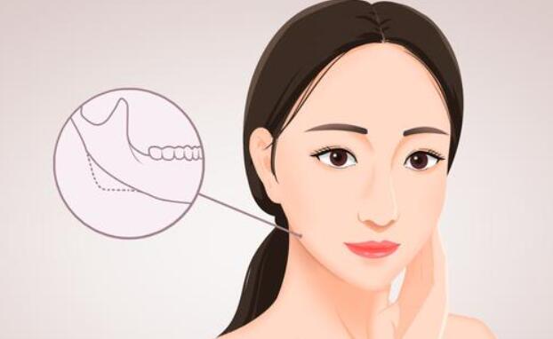 面部抽脂的注意事项有哪些？效果怎么样？超全笔记~