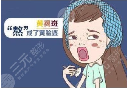 激光可以去除黄褐斑吗？多少钱一次呢？祛除后会不会出现反弹？快来详细了解一下吧！