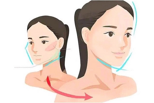 整瓜子脸需要多少钱？整瓜子脸是什么原理？提升魅力值~