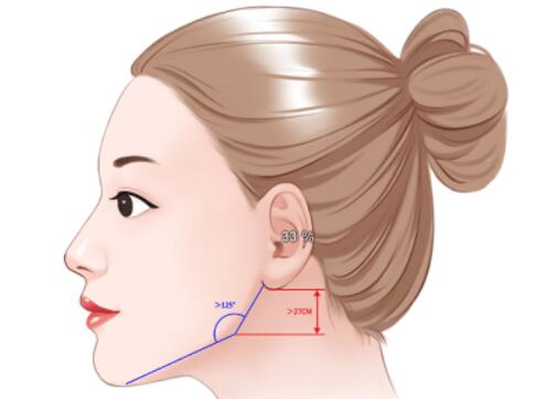 女人后缩下颌角整形效果好不好？有什么注意事项吗？