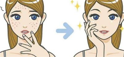 彩光嫩肤有什么副作用吗？光子嫩肤的技术特点有哪些？