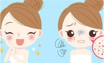 黄褐斑去除了还会长吗，术后有哪些注意事项？详情介绍！